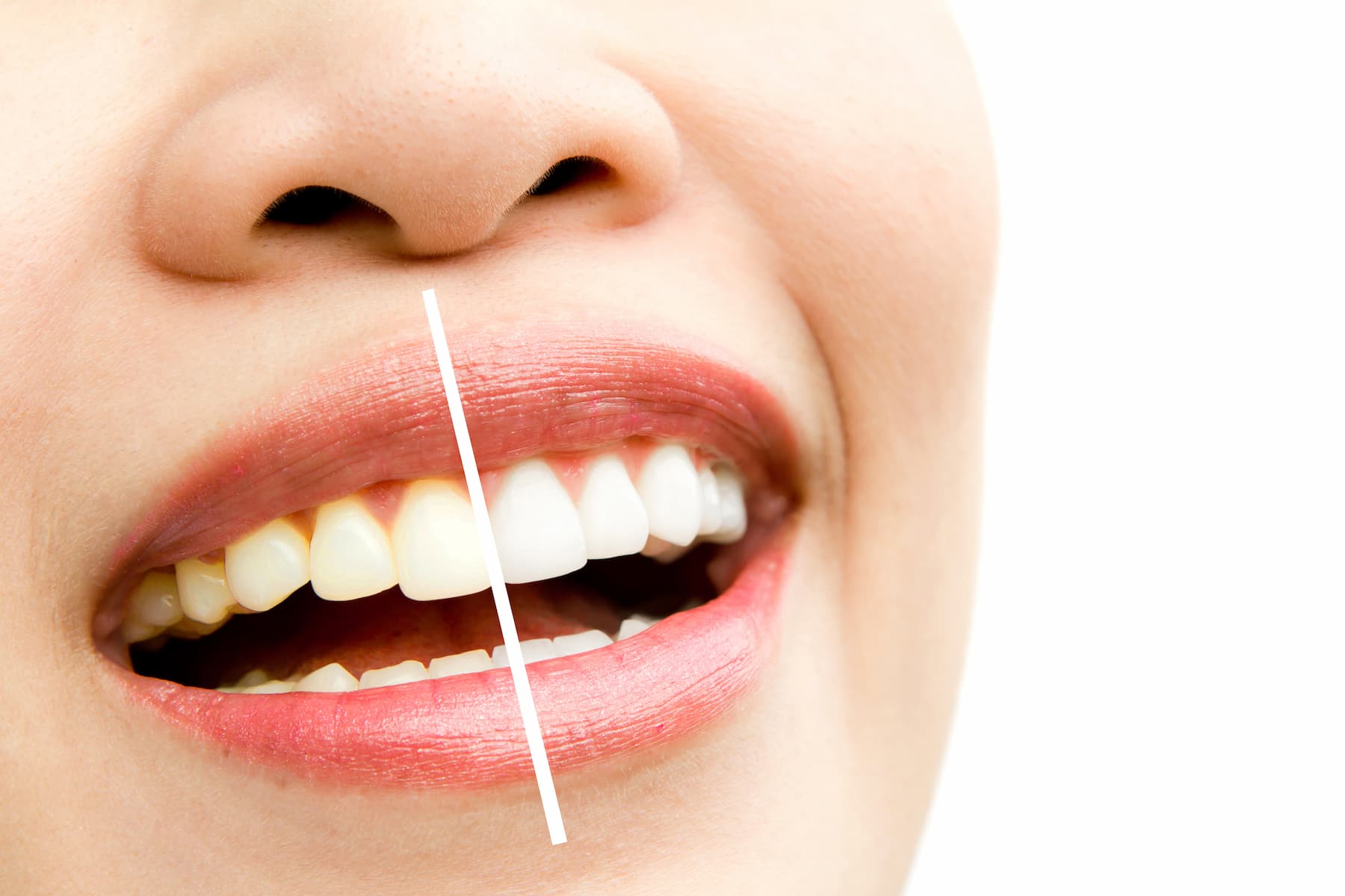 Cuidado dental profesional clave para una sonrisa saludable